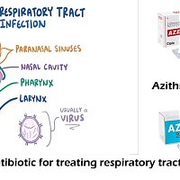 Azithromycin: A popular antibiotic for treating respiratory tract infection
