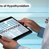 Complications of Hypothyroidism: A Comprehensive Guide for You