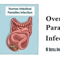 Parasitic worm infections: An Ultimate Guide