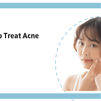 Which are the Common Antibiotics used to treat Acne