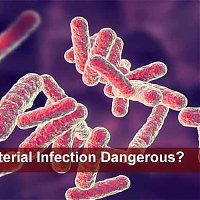 Is Bacterial Infection Dangerous?