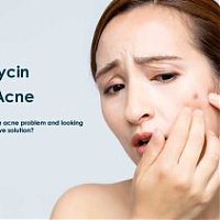 How does Clindamycin work for treating acne problems?