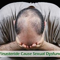 Does Finasteride Cause Sexual Dysfunction?