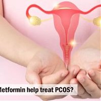 How does Metformin help treat PCOS?