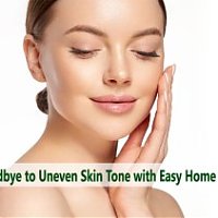 Say Goodbye to Uneven Skin Tone with Easy Home Remedies