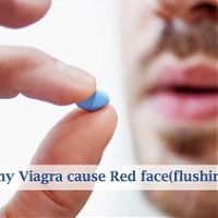 How to Get Rid of the Red face from Viagra